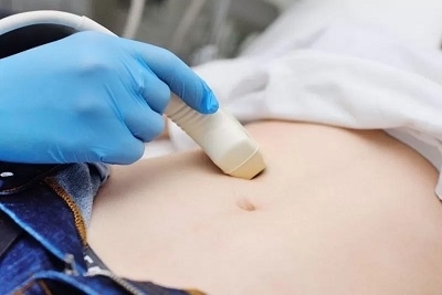 Internistički pregled, EKG i ultrazvuk abdomena , Popust