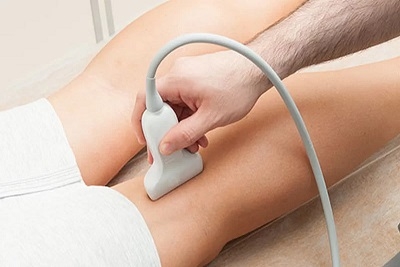 Kolor dopler krvnih sudova nogu uz D dimer, Popusti