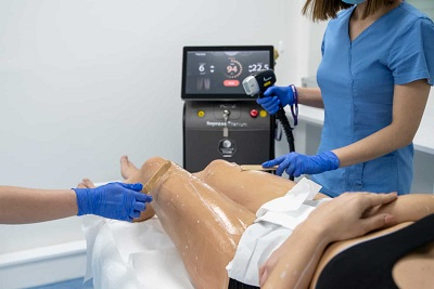 Laserska epilacija - Medicinski laser Alma Soprano Titanium  slika 1