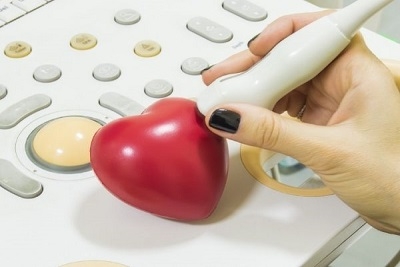 Ultrazvuk srca i color doppler krvnih sudova vrata ili nogu,Popust